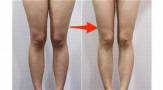 肌肉型蘿蔔腿 埋線