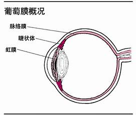 葡萄性眼膜炎